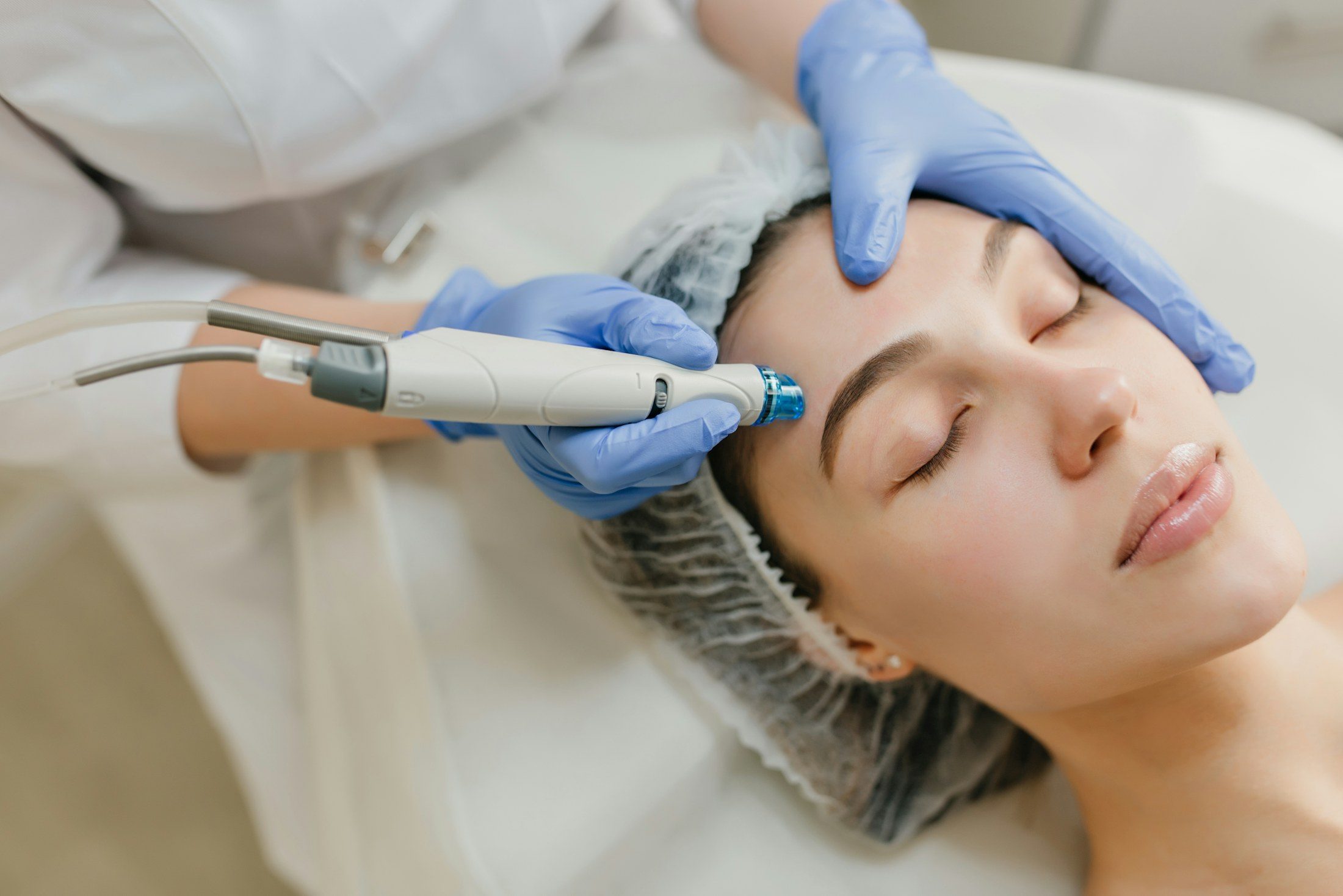 Microneedling- und Glow-Solution-Behandlung für strahlende Haut